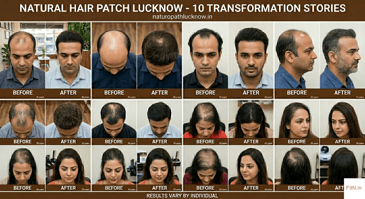 Before and after results of Natural Hair Patch treatment in Lucknow