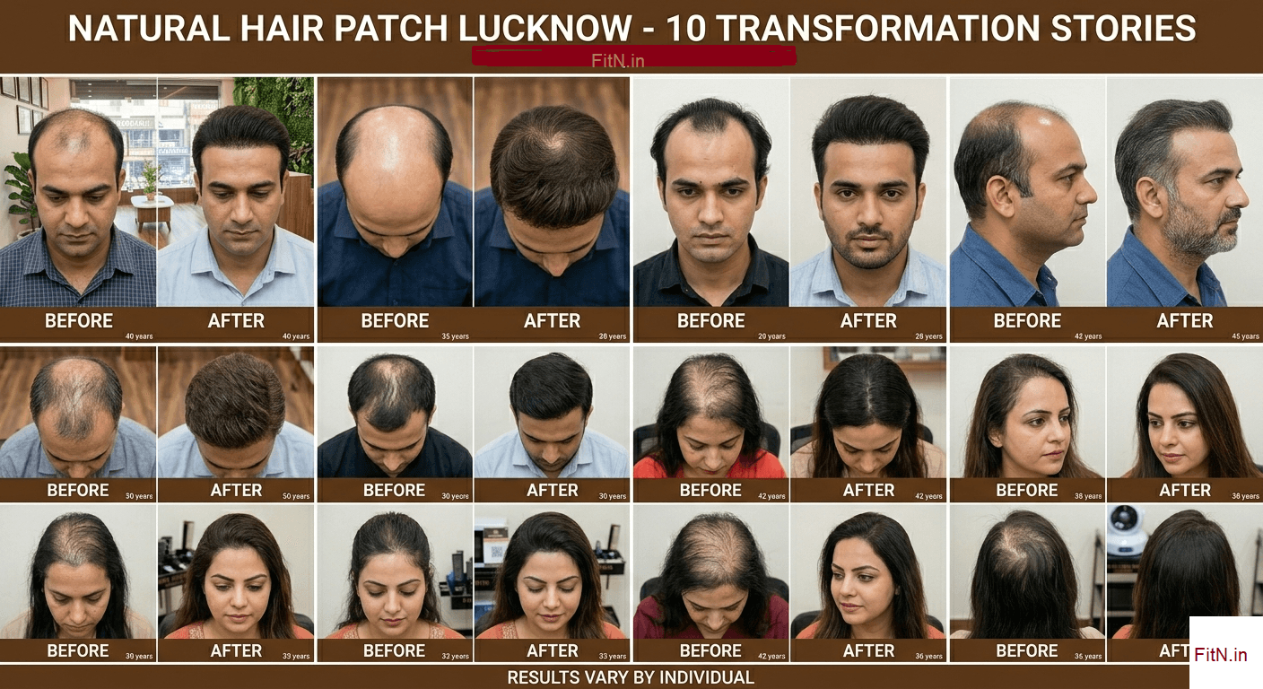 Professional hair patch expert working with a client in Lucknow